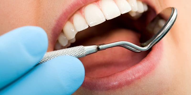 بهبودی کامل پس از کشیدن دندان عقل چه مدتی طول می‌کشد؟