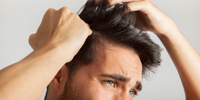چگونه ریزش مو را کنترل کنیم