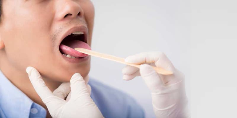 سرطان زبان؛ علائم، تشخیص و درمان